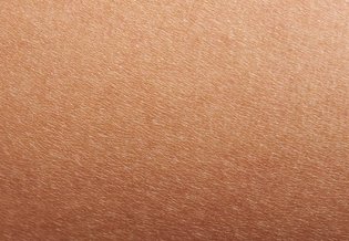 Larocheposay ArticlePage Eczema Dry skin vs eczema