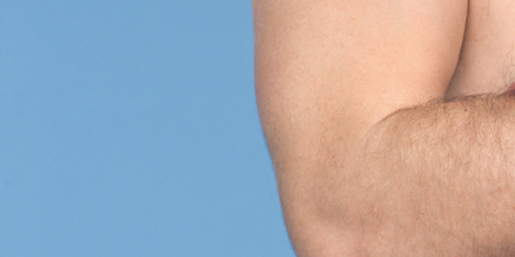 Oorzaken En Oplossingen Voor Huiduitslag Door La Roche Posay