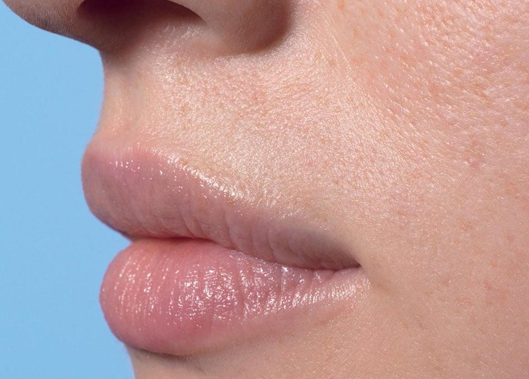 La Roche Posay By Need Face Care Lip Care