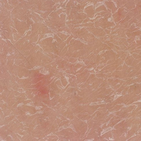 Before Urea 30