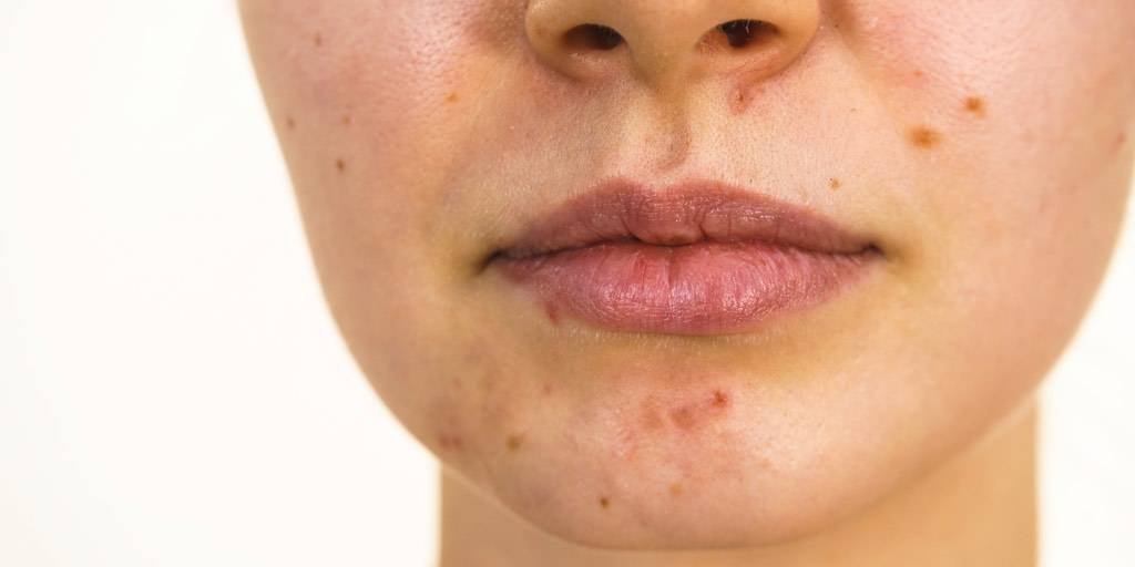 Oncology 2021 side effects skin swelling banner