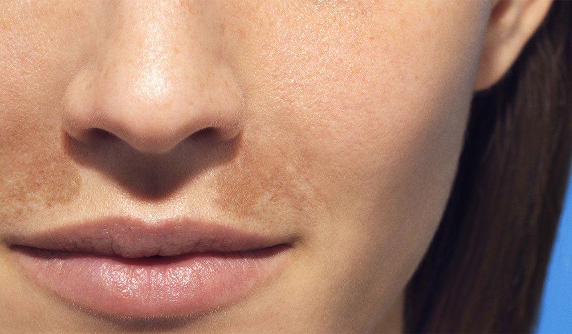 laserontharing
laser behandeling
permanente ontharing
gezichtsontharing
laseren ontharen
definitief ontharen
laser ontharen
ontharing met laser
permanente laserontharing
bikinilijn laseren
laserbehandeling
laserontharing prijs
permanent ontharen
laser haar verwijderen
laseren bikinilijn
laser ontharing
haar laseren
ontharen met laser
ontharing
diodelaser
ontharing bikinilijn
permanente ontharing prijs
gezicht ontharen
haar laseren prijs
ipl laser ontharing
ipl laserontharing
oksels laseren
intiem ontharen
bikinilijn ontharing
ontharing benen
bikinilijn scheren alles weg
laserontharing thuis
ontharen bikinilijn
ontharingsapparaat
gezichtsbehandeling
gelaatsverzorging
powderbrows
powder brows
powder brows voor en na
powder brows prijs
brow lift
semi permanente make up
tanden bleken
tandenbleken
tanden witter maken
tanden bleachen
wittere tanden
tanden laten bleken
tanden bleachen prijs
tanden bleken prijs
bleaching tanden prijs
bleachen tanden