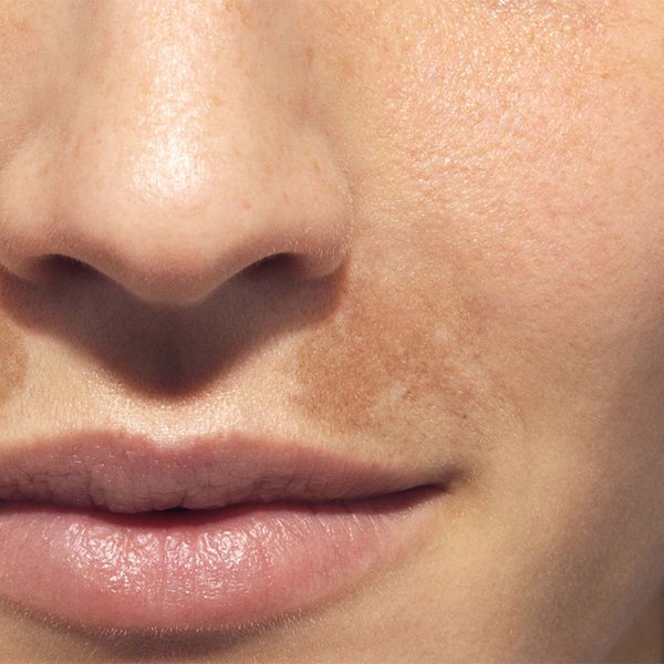 laserontharing
laser behandeling
permanente ontharing
gezichtsontharing
laseren ontharen
definitief ontharen
laser ontharen
ontharing met laser
permanente laserontharing
bikinilijn laseren
laserbehandeling
laserontharing prijs
permanent ontharen
laser haar verwijderen
laseren bikinilijn
laser ontharing
haar laseren
ontharen met laser
ontharing
diodelaser
ontharing bikinilijn
permanente ontharing prijs
gezicht ontharen
haar laseren prijs
ipl laser ontharing
ipl laserontharing
oksels laseren
intiem ontharen
bikinilijn ontharing
ontharing benen
bikinilijn scheren alles weg
laserontharing thuis
ontharen bikinilijn
ontharingsapparaat
gezichtsbehandeling
gelaatsverzorging
powderbrows
powder brows
powder brows voor en na
powder brows prijs
brow lift
semi permanente make up
tanden bleken
tandenbleken
tanden witter maken
tanden bleachen
wittere tanden
tanden laten bleken
tanden bleachen prijs
tanden bleken prijs
bleaching tanden prijs
bleachen tanden